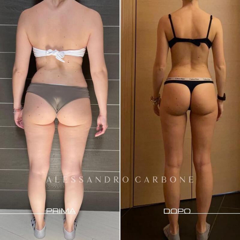 Testimonianza 3 - Prima e Dopo