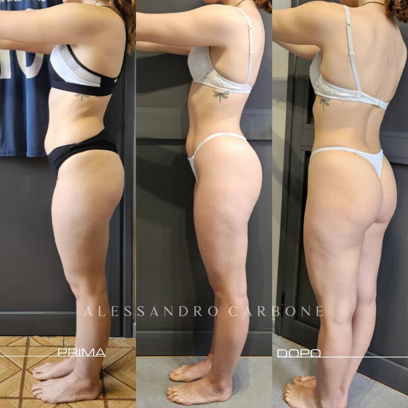 Testimonianza 18 - Foto 2