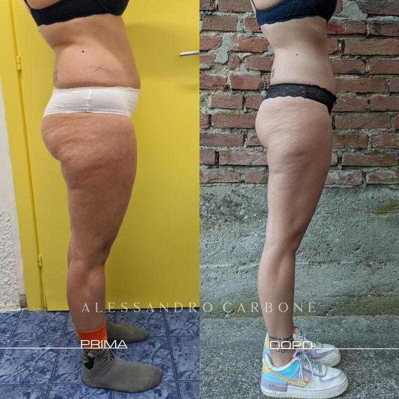 Testimonianza 2 - Foto 2