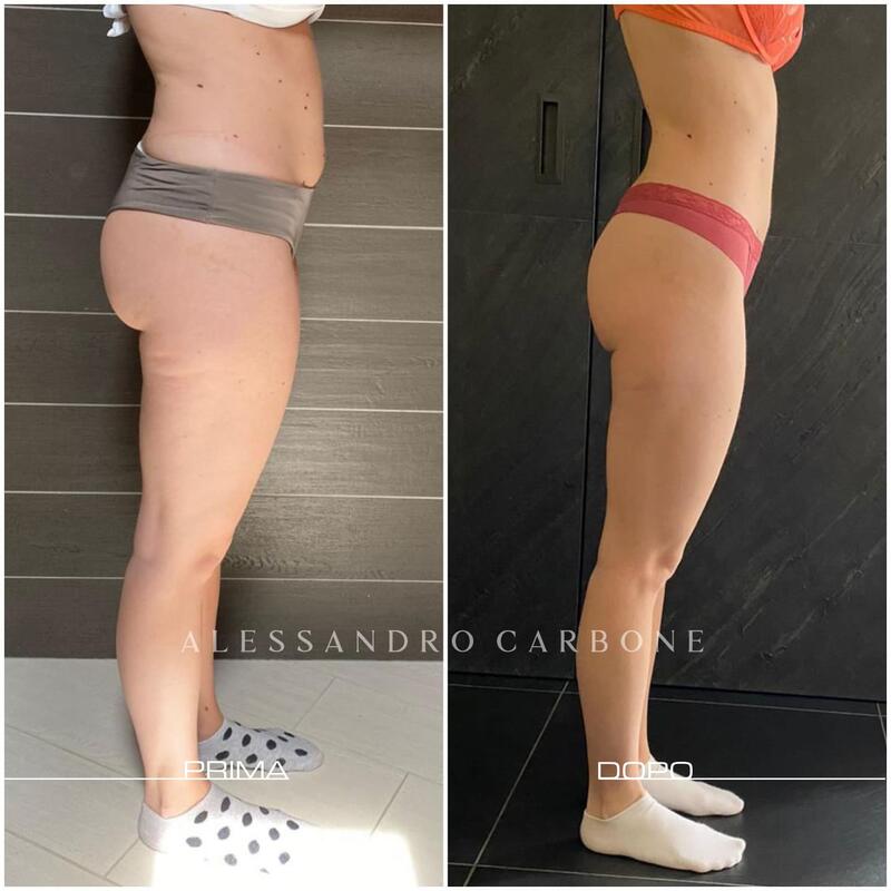 Testimonianza 23 - Foto 3