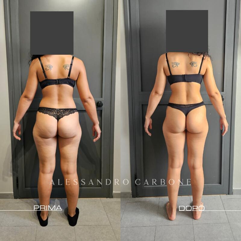 Testimonianza 25 - Foto 2