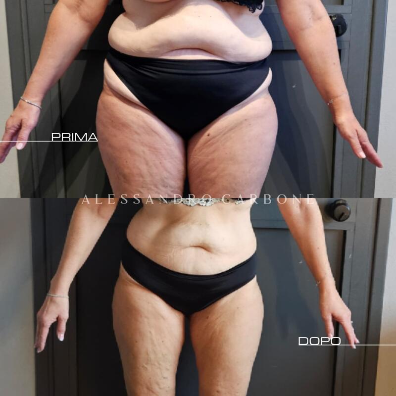 Testimonianza 35 - Foto 1