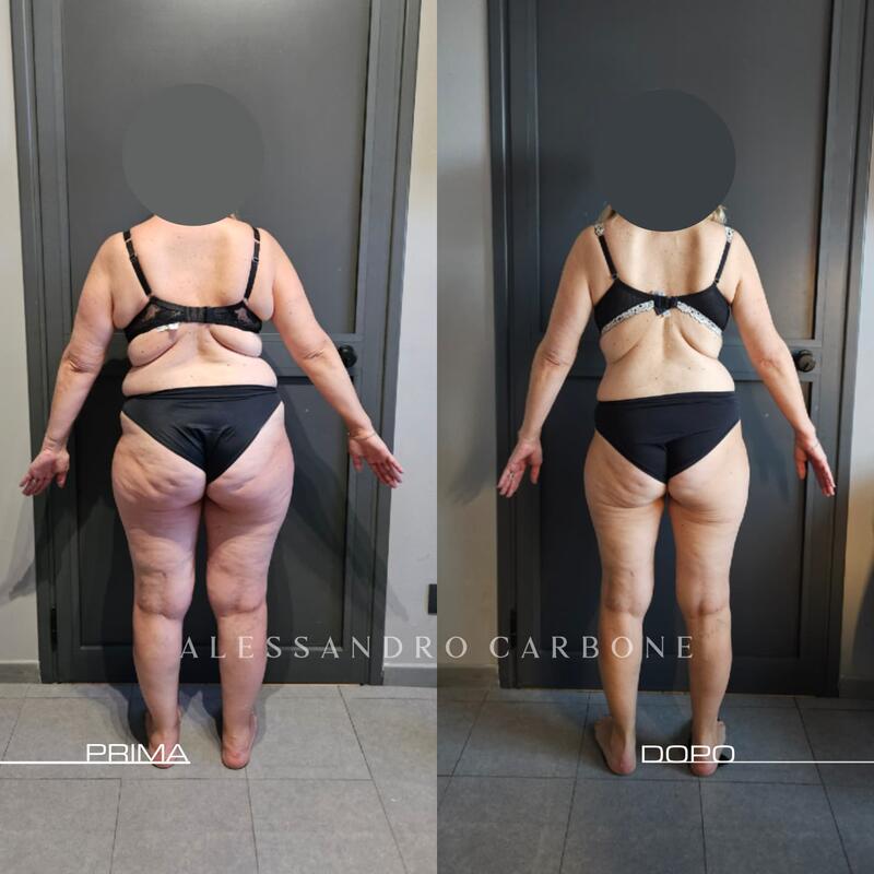 Testimonianza 35 - Foto 3