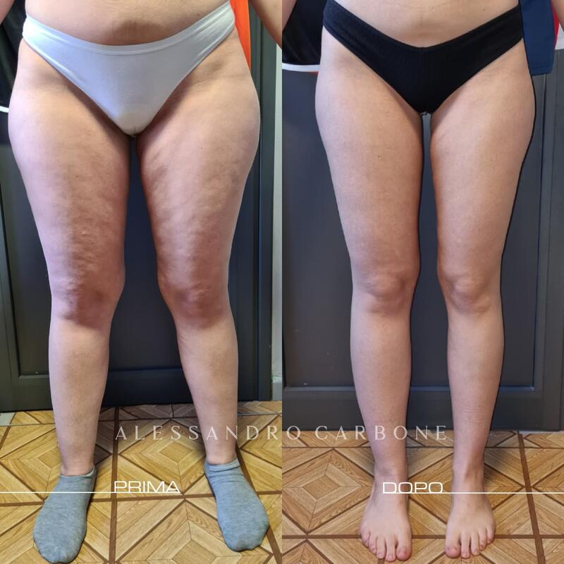 Testimonianza 37 - Foto 3