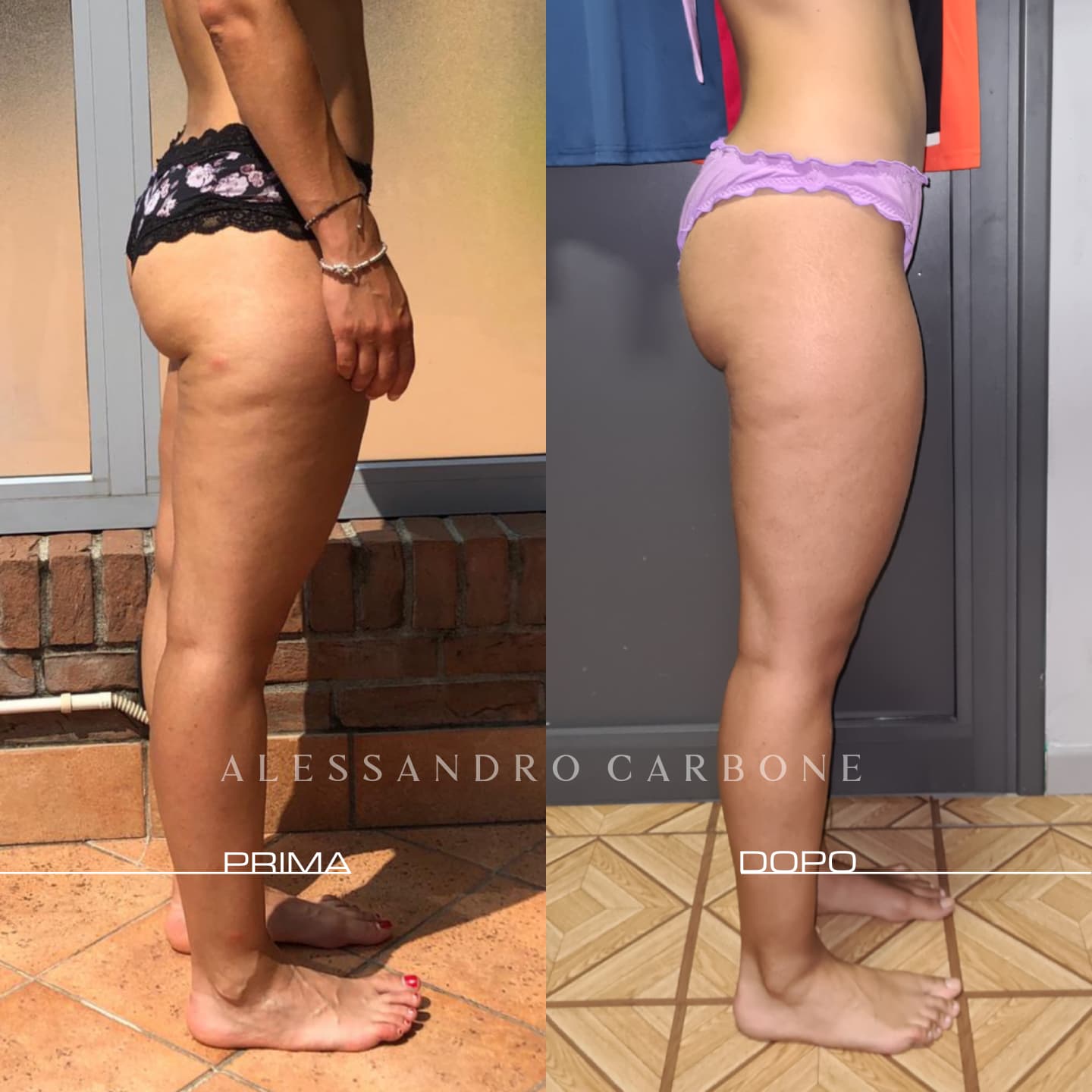 Testimonianza 44 - Foto 2